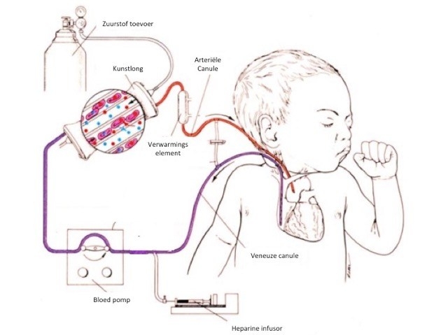 Werking ECMO